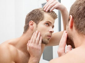 Hair Loss